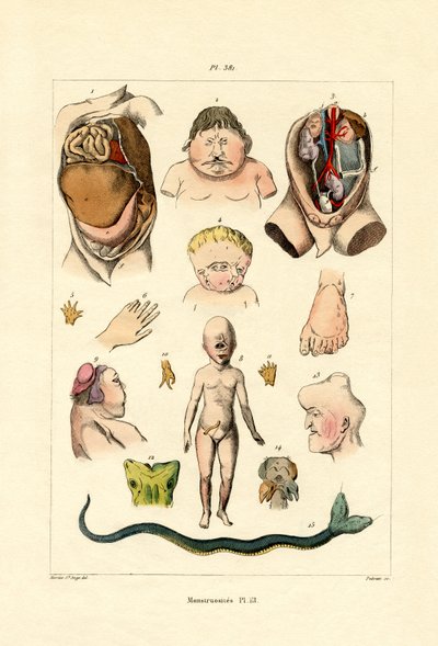 Freak von French School
